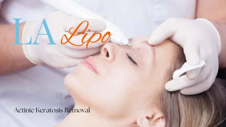 Woman receiving Actinic Keratosis Removal Treatment Weybridge