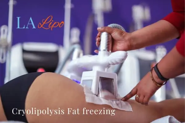 women getting fat freezing Weybridge