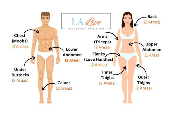 LA LIPO Cryolipolysis Areas Weybridge