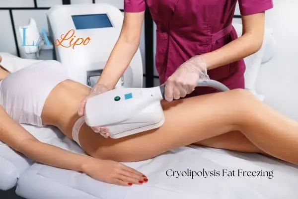 Woman receiving coolsculpting Weybridge treatment on her thighs