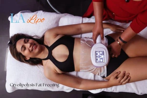 woman getting cryolipolysis Weybridge