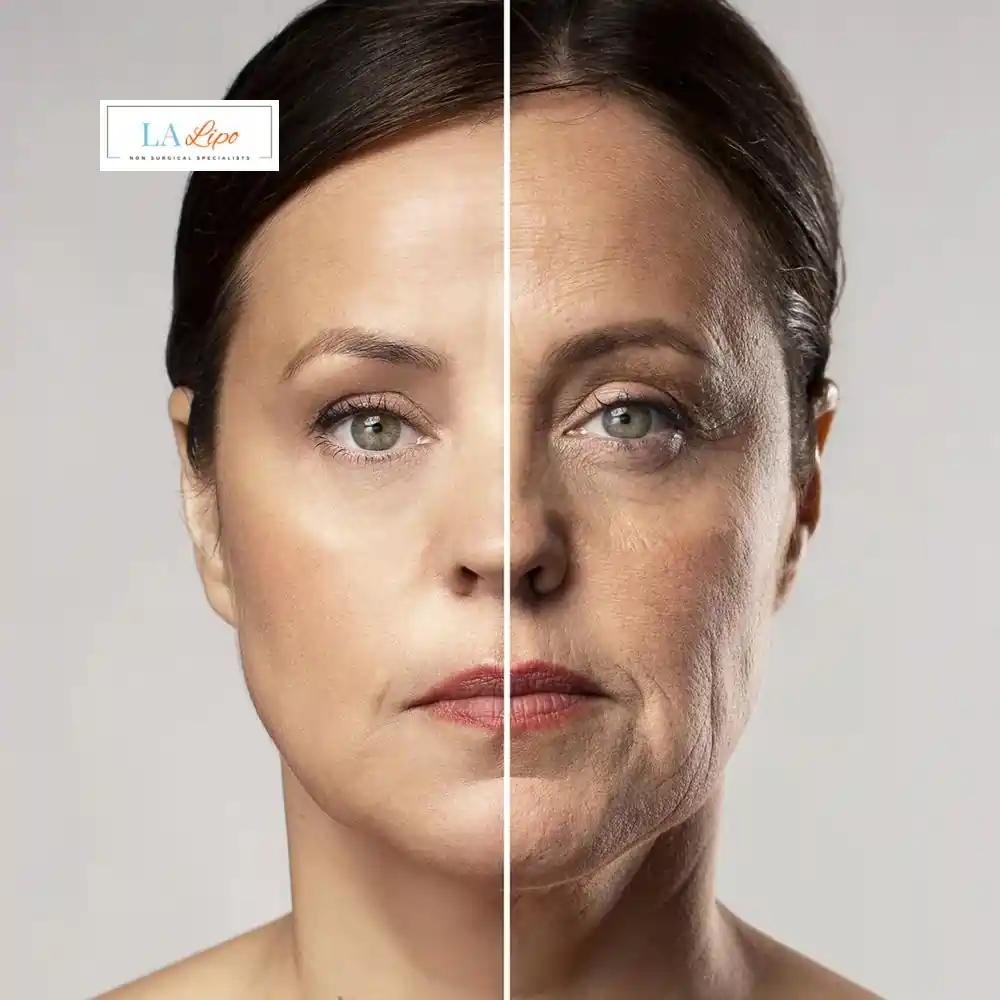 How Can You Tell If Non-Surgical Skin Tightening Is Right for You Weybridge?