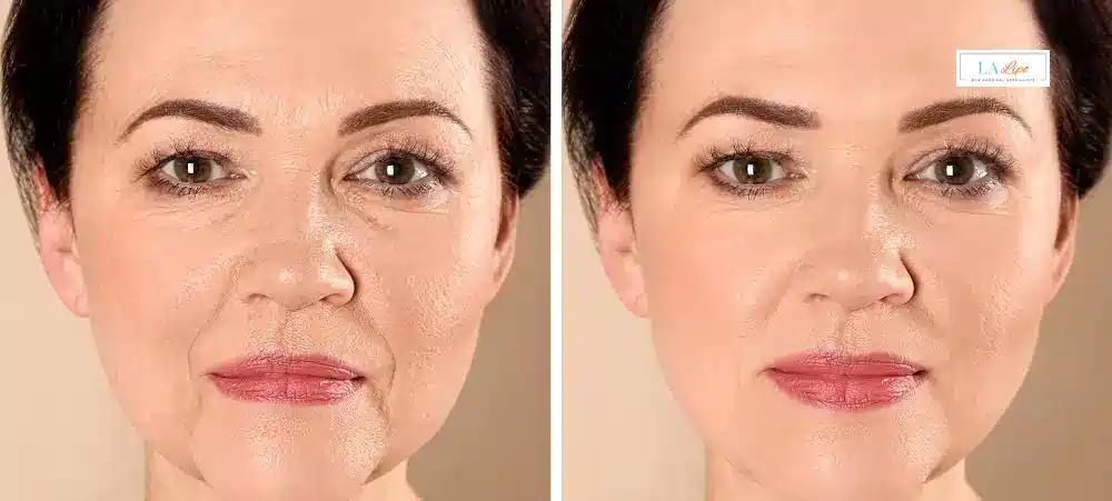 How Long Does It Take to See Results and How Long Do They Last Weybridge?