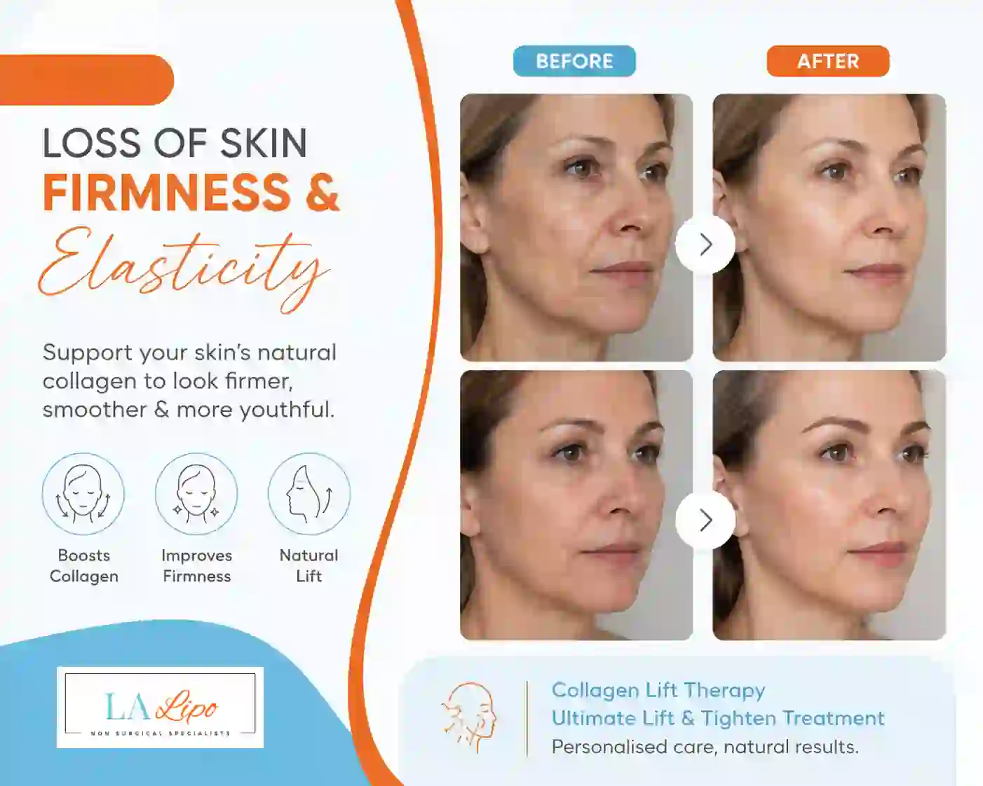 Sign #7: Loss of Skin Firmness and Elasticity Weybridge