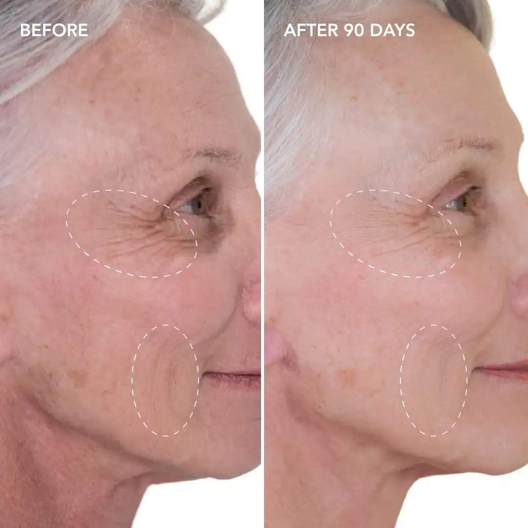 When will you see results Weybridge